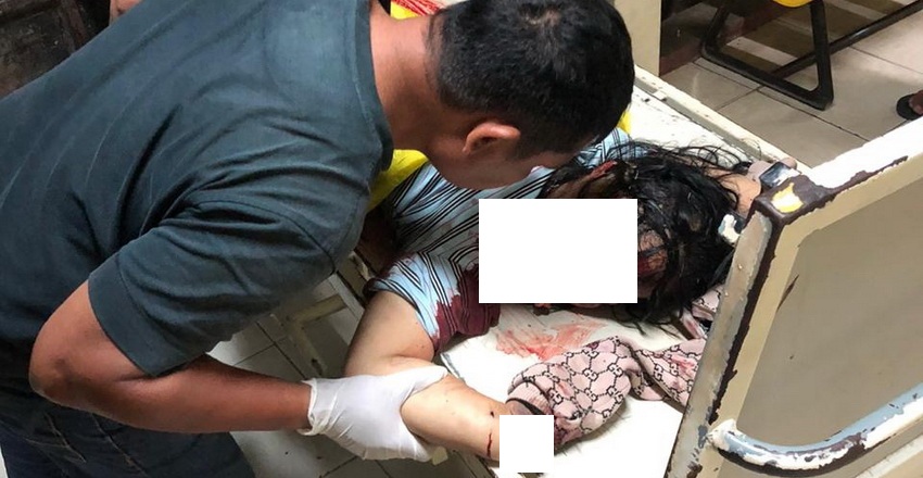 Lakalantas Tunggal, Wanita Asal Batubara Tewas di Jalan AH Nasution Medan