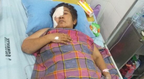 Bukti Kota Medan Belum Aman, Geng Motor Lukai Seorang Ibu Hingga Mata Nyaris Diangkat