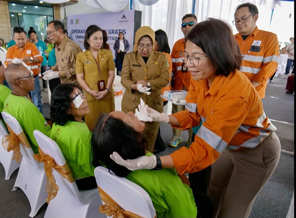 Direktur RSKM Mencirim 77 Berdoa PT Agincourt Resources Terus Laksanakan Operasi Katarak Gratis, Yakin Manajemen Terbuka Terhadap Masukan